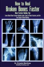How to Heal Broken Bones Faster. Bone Fracture Healing Tips : Learn about Bone Fracture Healing Foods, Types of Bone Fractures, and the Five Stages of Bone Healing